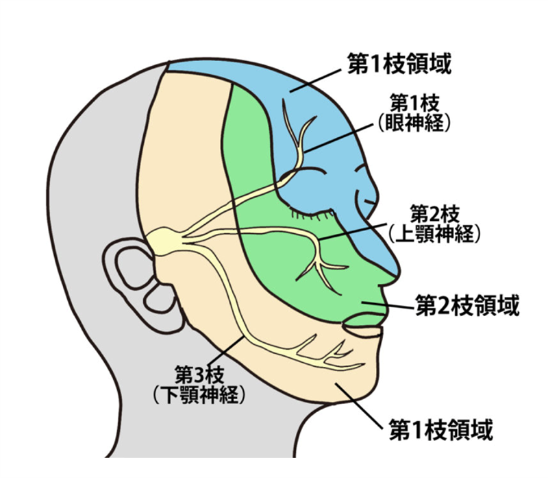 三叉神経痛